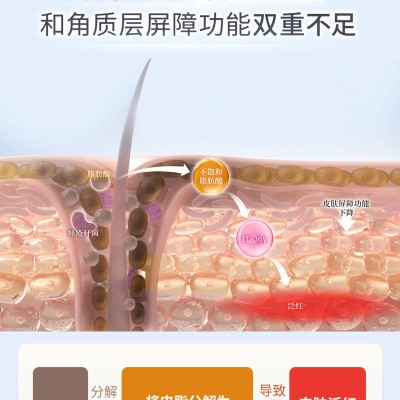 夏秋换季肌肤“矛盾感”来袭｜读懂油敏红，科学修护外油内干